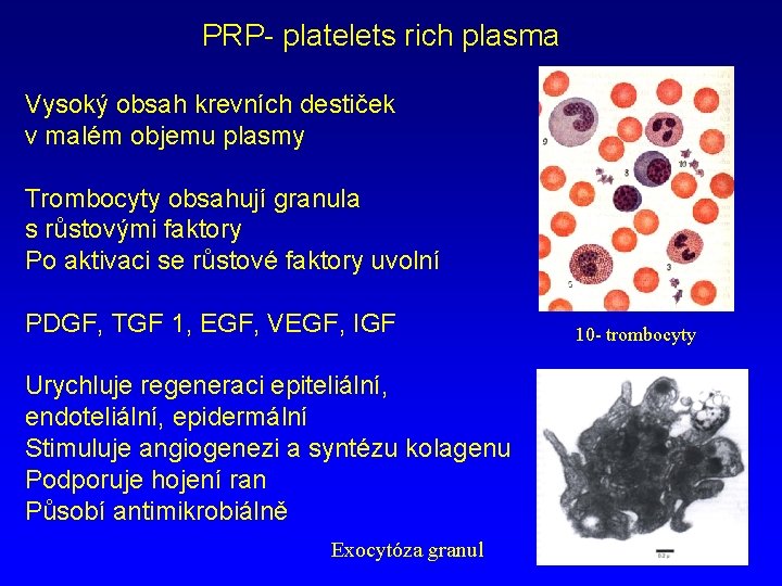 PRP- platelets rich plasma Vysoký obsah krevních destiček v malém objemu plasmy Trombocyty obsahují