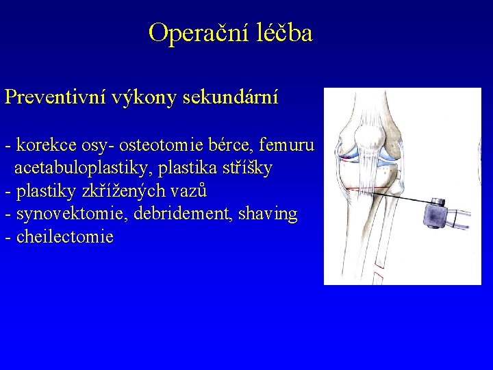 Operační léčba Preventivní výkony sekundární - korekce osy- osteotomie bérce, femuru acetabuloplastiky, plastika stříšky