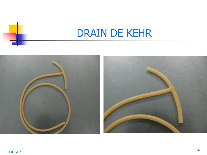 DRAIN DE KEHR 30/01/07 4 
