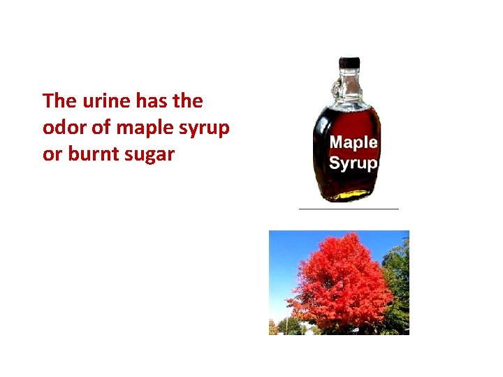 The urine has the odor of maple syrup or burnt sugar 