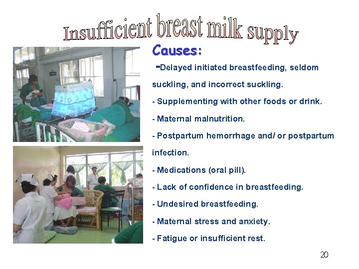Causes: -Delayed initiated breastfeeding, seldom suckling, and incorrect suckling. - Supplementing with other foods
