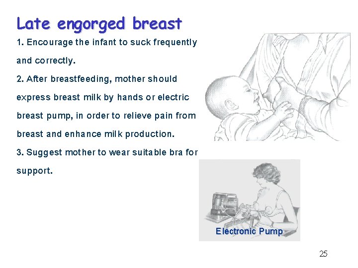 Late engorged breast 1. Encourage the infant to suck frequently and correctly. 2. After