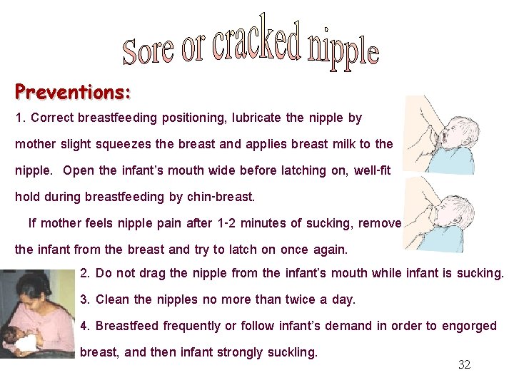Preventions: 1. Correct breastfeeding positioning, lubricate the nipple by mother slight squeezes the breast