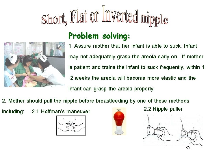 Problem solving: 1. Assure mother that her infant is able to suck. Infant may