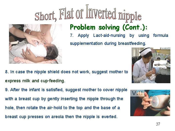 Problem solving (Cont. ): 7. Apply Lact-aid-nursing by using formula supplementation during breastfeeding. 8.