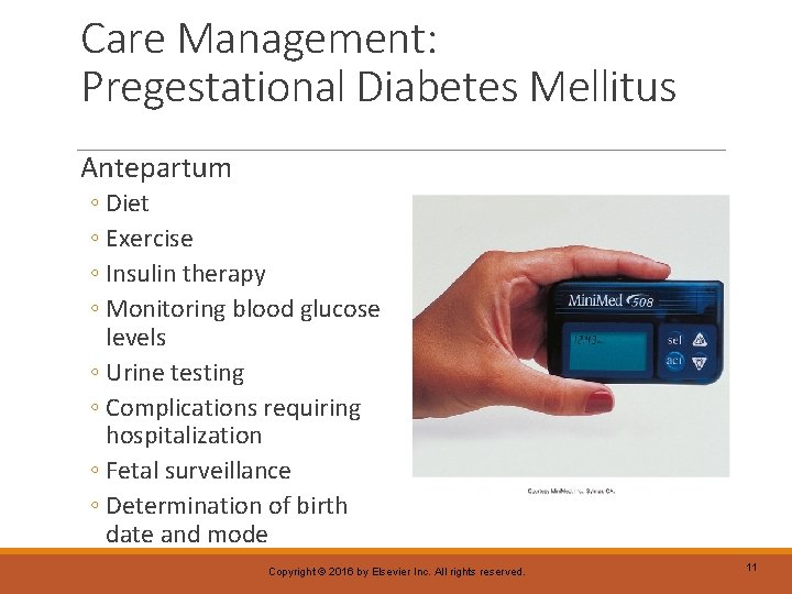 Care Management: Pregestational Diabetes Mellitus Antepartum ◦ Diet ◦ Exercise ◦ Insulin therapy ◦