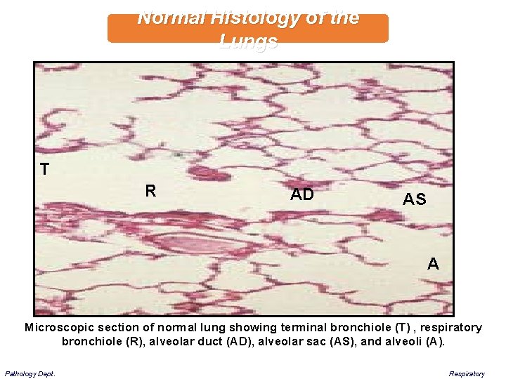 Normal Histology of the Lungs T R AD AS A Microscopic section of normal