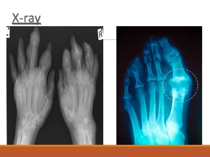 X-ray 