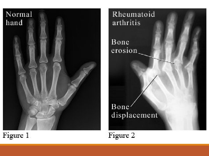 X-Ray 