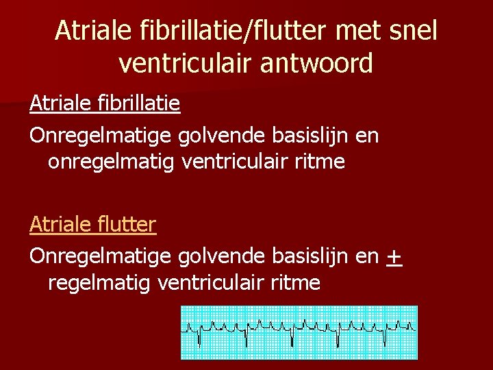 Atriale fibrillatie/flutter met snel ventriculair antwoord Atriale fibrillatie Onregelmatige golvende basislijn en onregelmatig ventriculair