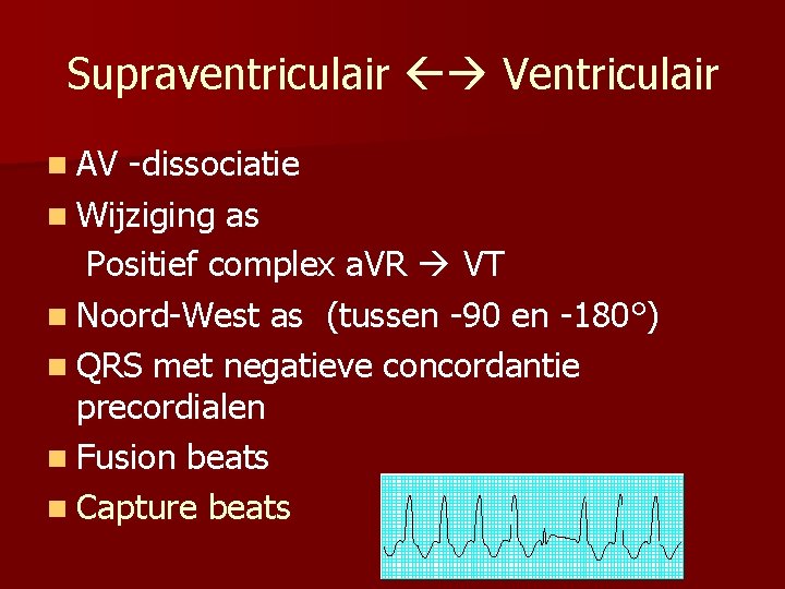 Supraventriculair Ventriculair n AV -dissociatie n Wijziging as Positief complex a. VR VT n