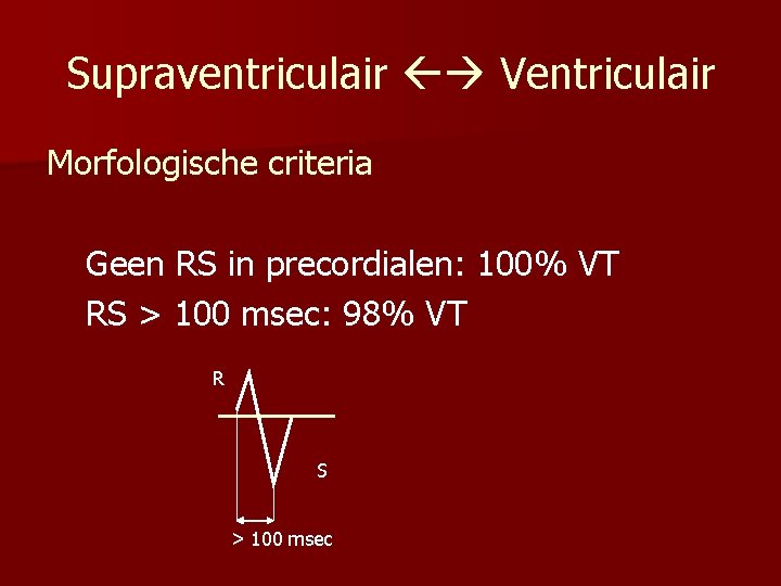 Supraventriculair Ventriculair Morfologische criteria Geen RS in precordialen: 100% VT RS > 100 msec:
