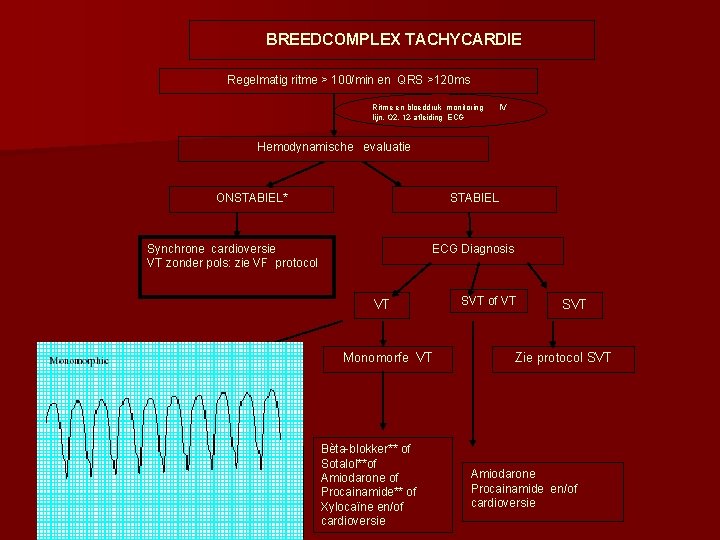 BREEDCOMPLEX TACHYCARDIE Regelmatig ritme > 100/min en QRS >120 ms Ritme en bloeddruk monitoring