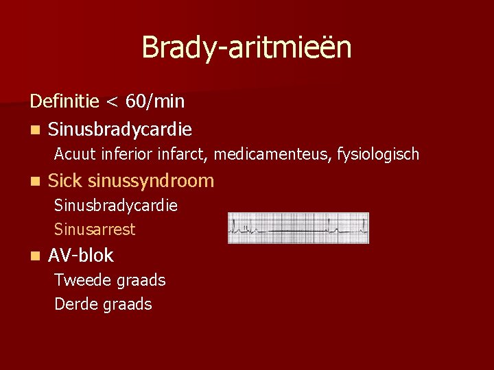 Brady-aritmieën Definitie < 60/min n Sinusbradycardie Acuut inferior infarct, medicamenteus, fysiologisch n Sick sinussyndroom