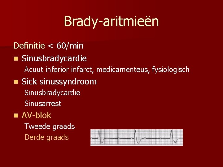 Brady-aritmieën Definitie < 60/min n Sinusbradycardie Acuut inferior infarct, medicamenteus, fysiologisch n Sick sinussyndroom