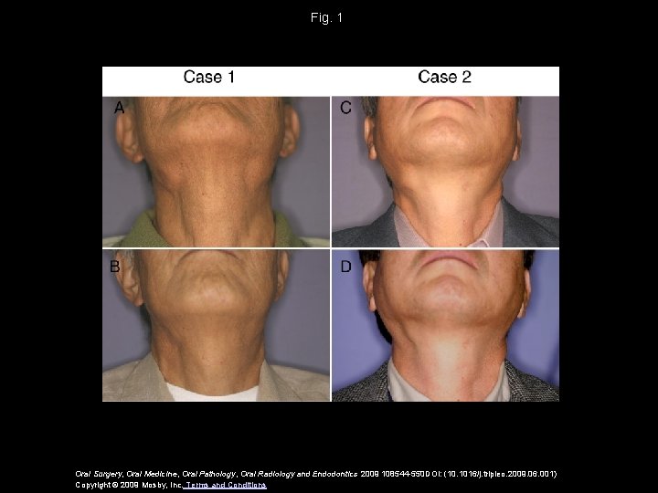 Fig. 1 Oral Surgery, Oral Medicine, Oral Pathology, Oral Radiology and Endodontics 2009 108544