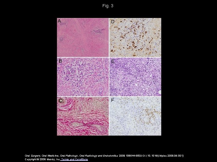 Fig. 3 Oral Surgery, Oral Medicine, Oral Pathology, Oral Radiology and Endodontics 2009 108544