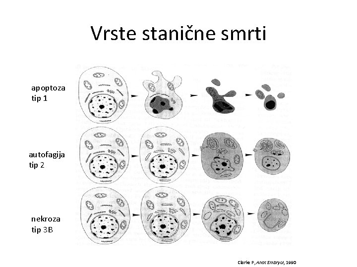 Vrste stanične smrti apoptoza tip 1 autofagija tip 2 nekroza tip 3 B Clarke