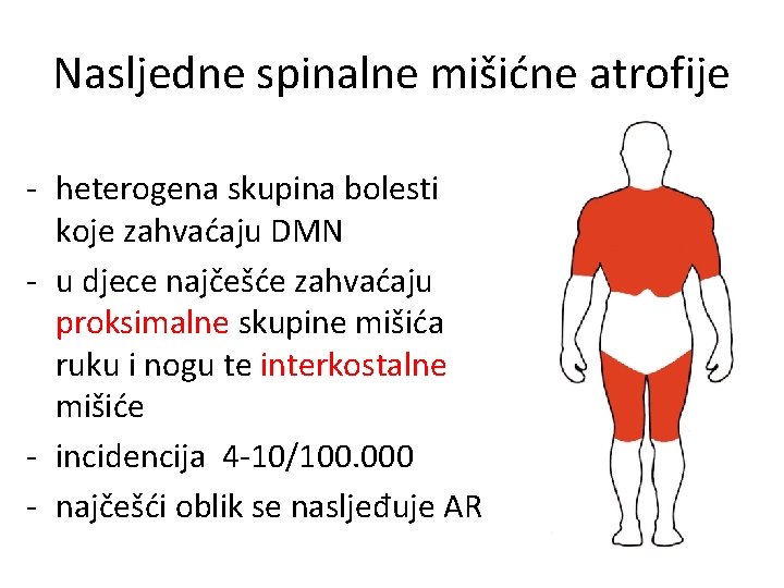 Nasljedne spinalne mišićne atrofije - heterogena skupina bolesti koje zahvaćaju DMN - u djece