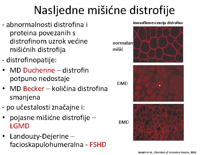 Nasljedne mišićne distrofije - abnormalnosti distrofina i proteina povezanih s distrofinom uzrok većine mišićnih