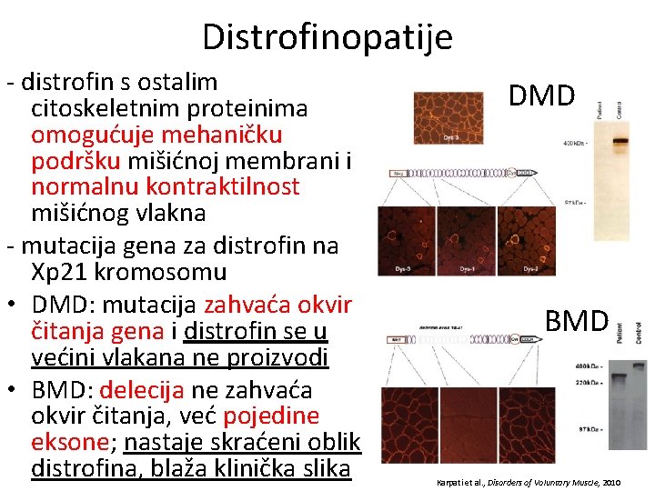 Distrofinopatije - distrofin s ostalim citoskeletnim proteinima omogućuje mehaničku podršku mišićnoj membrani i normalnu