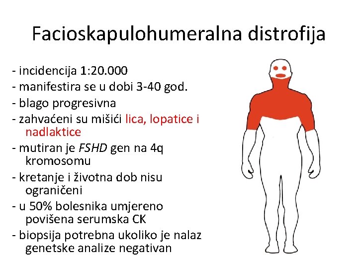 Facioskapulohumeralna distrofija - incidencija 1: 20. 000 - manifestira se u dobi 3 -40