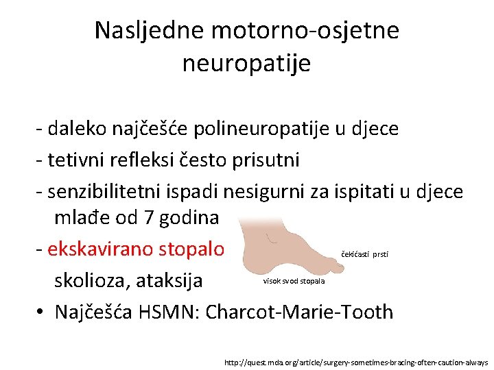 Nasljedne motorno-osjetne neuropatije - daleko najčešće polineuropatije u djece - tetivni refleksi često prisutni