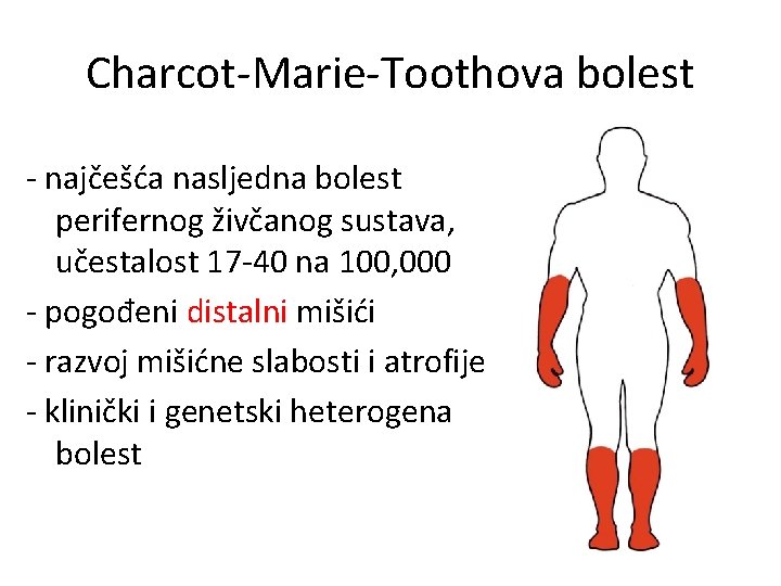 Charcot-Marie-Toothova bolest - najčešća nasljedna bolest perifernog živčanog sustava, učestalost 17 -40 na 100,