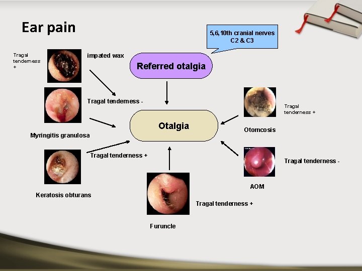 Ear pain Tragal tenderness + 5, 6, 10 th cranial nerves C 2 &