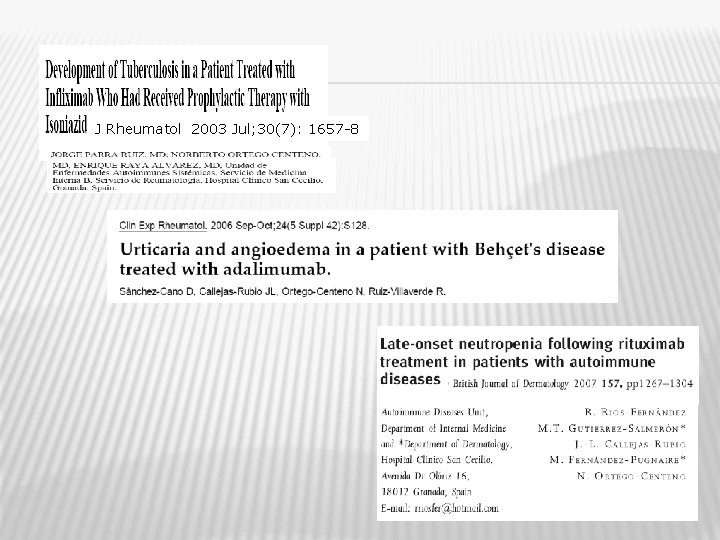 J Rheumatol 2003 Jul; 30(7): 1657 -8 