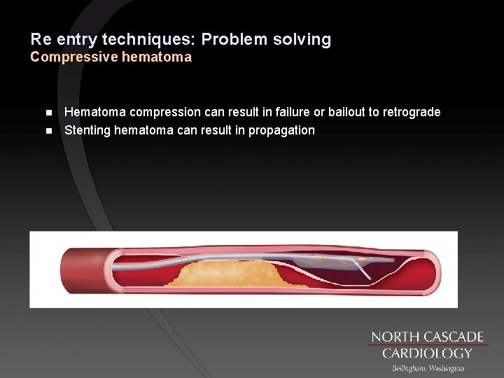 Re entry techniques: Problem solving Compressive hematoma n n Hematoma compression can result in