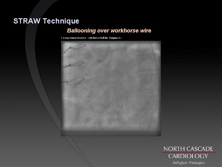 STRAW Technique Ballooning over workhorse wire 