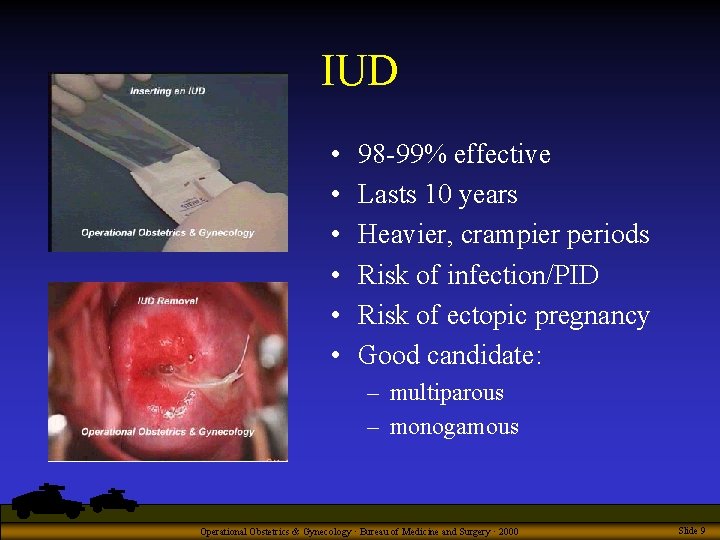 IUD • • • 98 -99% effective Lasts 10 years Heavier, crampier periods Risk