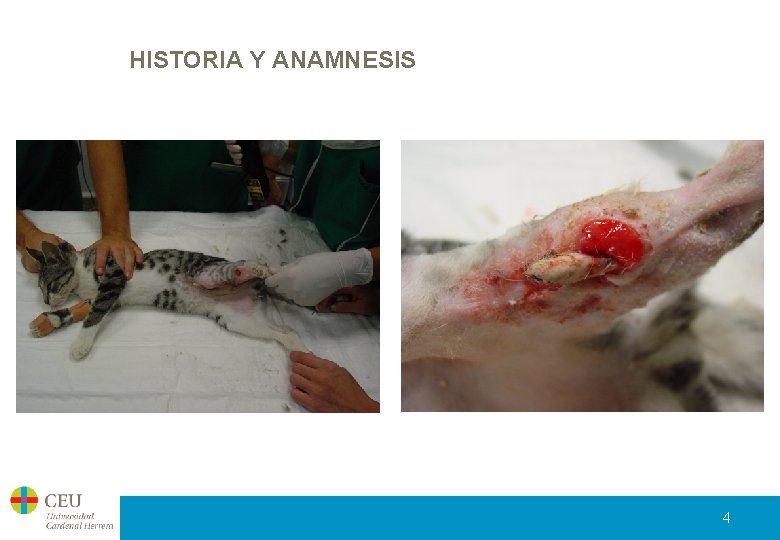 HISTORIA Y ANAMNESIS 4 