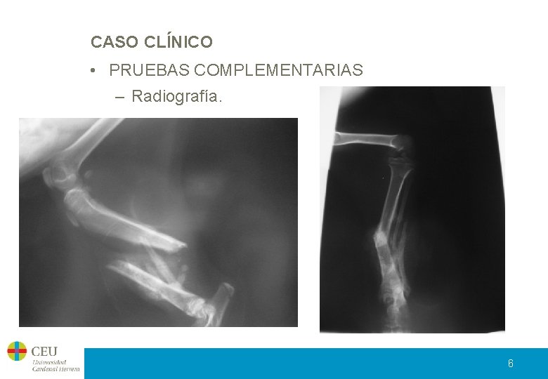 CASO CLÍNICO • PRUEBAS COMPLEMENTARIAS – Radiografía. 6 
