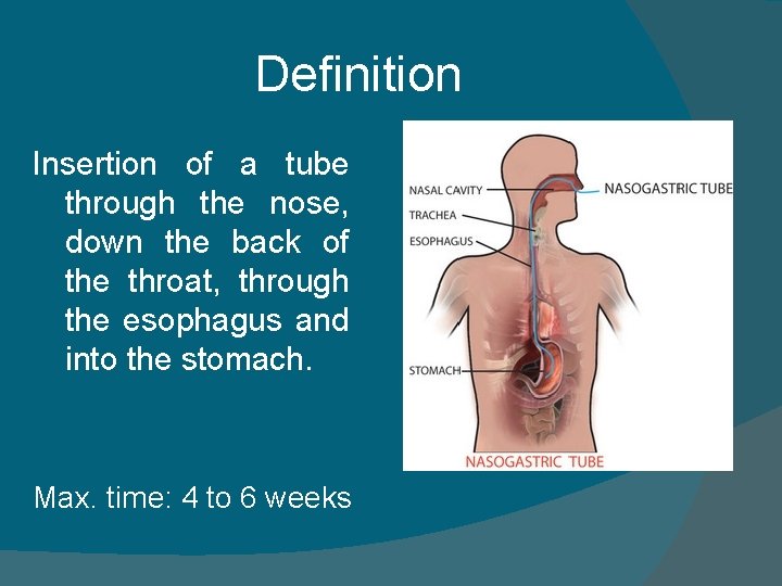 Definition Insertion of a tube through the nose, down the back of the throat,