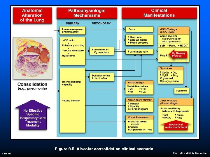 Figure 9 -8. Alveolar consolidation clinical scenario. Slide 10 Copyright © 2006 by Mosby,
