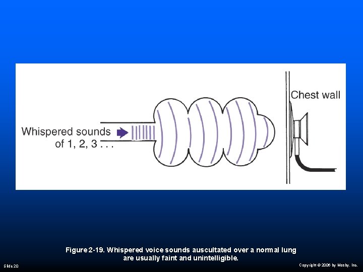 Figure 2 -19. Whispered voice sounds auscultated over a normal lung are usually faint