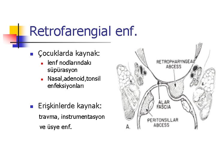 Retrofarengial enf. n Çocuklarda kaynak: n n n lenf nodlarındakı süpürasyon Nasal, adenoid, tonsil