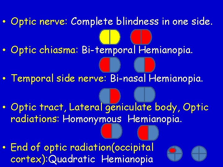  • Optic nerve: Complete blindness in one side. • Optic chiasma: Bi-temporal Hemianopia.