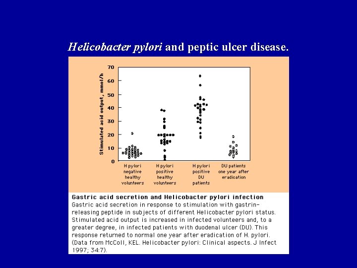 Helicobacter pylori and peptic ulcer disease. 