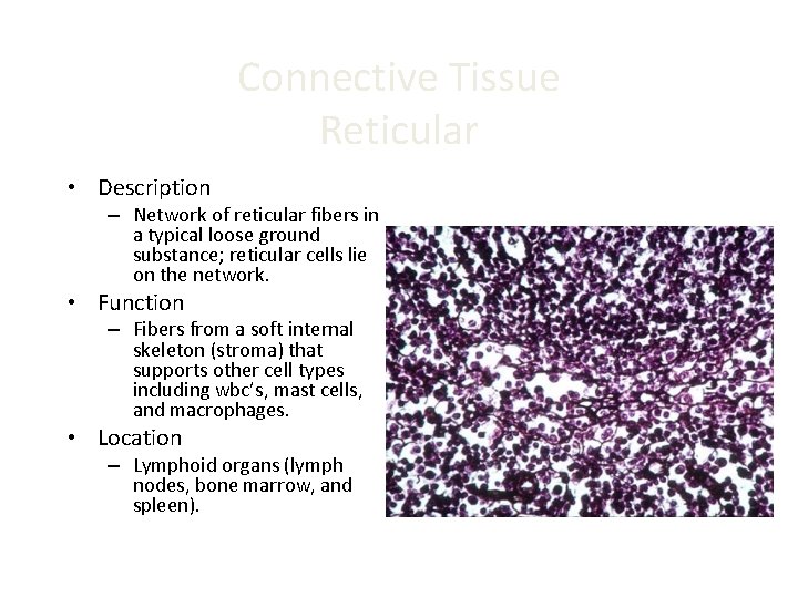 Connective Tissue Reticular • Description – Network of reticular fibers in a typical loose Connective Tissue Reticular • Description – Network of reticular fibers in a typical loose