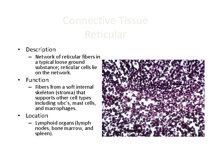 Connective Tissue Reticular • Description – Network of reticular fibers in a typical loose