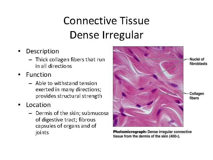 Connective Tissue Dense Irregular • Description – Thick collagen fibers that run in all Connective Tissue Dense Irregular • Description – Thick collagen fibers that run in all