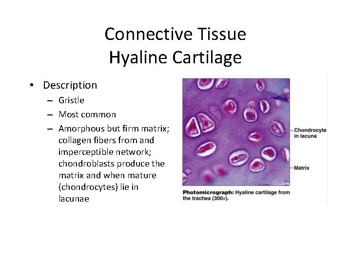 Connective Tissue Hyaline Cartilage • Description – Gristle – Most common – Amorphous but