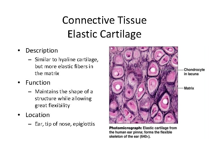Connective Tissue Elastic Cartilage • Description – Similar to hyaline cartilage, but more elastic