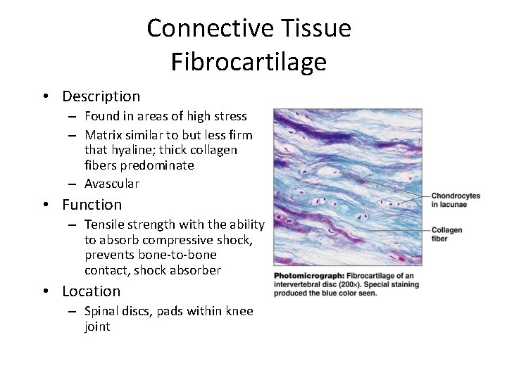 Connective Tissue Fibrocartilage • Description – Found in areas of high stress – Matrix