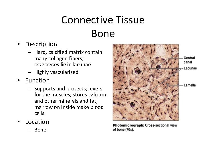 • Description Connective Tissue Bone – Hard, calcified matrix contain many collagen fibers;