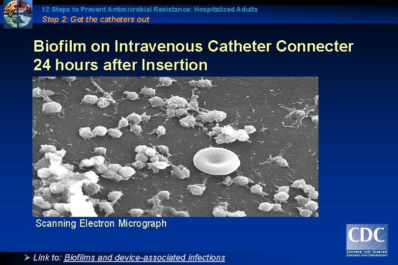 12 Steps to Prevent Antimicrobial Resistance: Hospitalized Adults Step 2: Get the catheters out