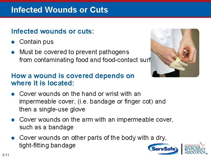 Infected Wounds or Cuts Infected wounds or cuts: l Contain pus l Must be